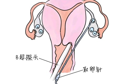 http://guangzhou.vdtfzz.com/post/205.html|广州供卵助孕